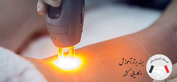 آیا اشعه لیزر سرطان زاست