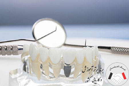 دستیار دندانساز کیست