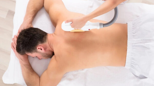 نکات قبل از لیزر مو های زائد