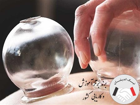 از نظر متخصصان، فصد خون بهتر است یا حجامت
