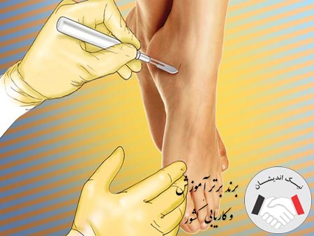 ایا فصد خون بهتر است یا حجامت